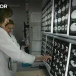 Óbitos anuais por neoplasias no planeta podem elevar-se quase 75% até 2050, revela pesquisa.