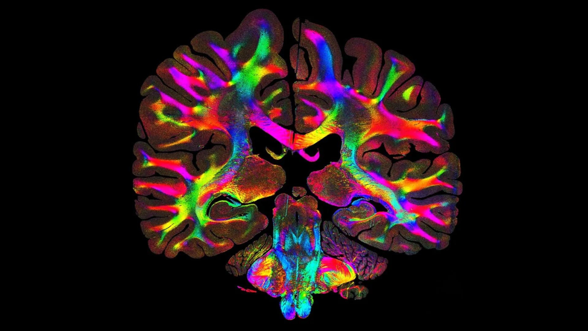 <p>Estratégia luminosa expõe trilhas neuronais ocultas em detalhes minuciosos.</p>