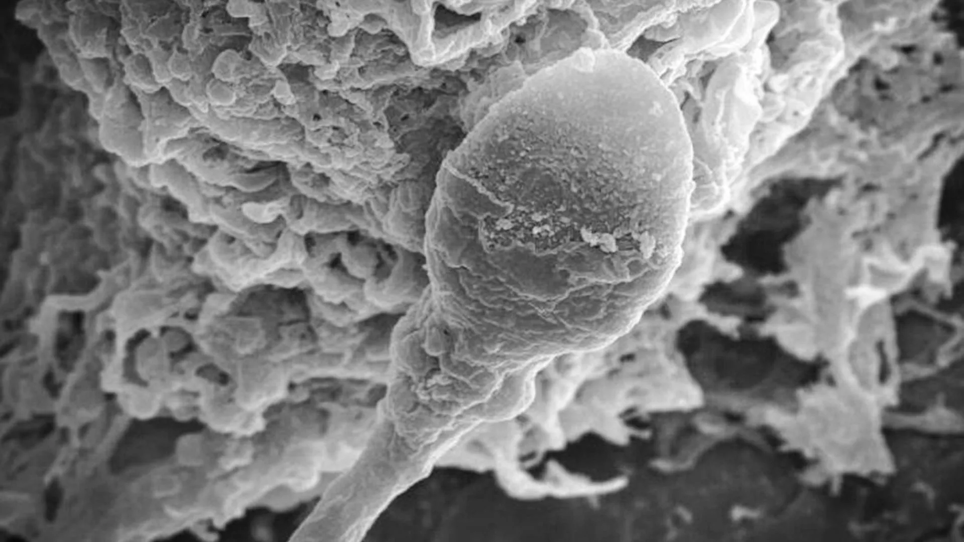 Perdidos no Cosmos: A Microgravitacionalidade Desorienta os Espermatozoides