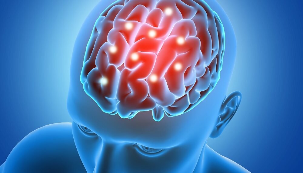 Os 7 sinais de perigo de tumor cerebral que você pode estar desconsiderando